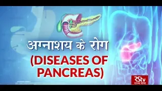 Ayushman Bhava: Pancreatic Diseases | अग्नाशय के रोग | Symptoms and Treatment
