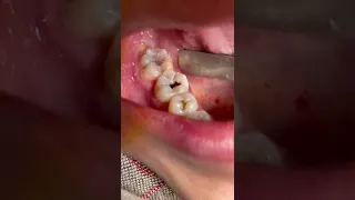 #tiktok #video #dentist #fyp #viral #family #trending #foryou #love #smile #blogger #happy#best