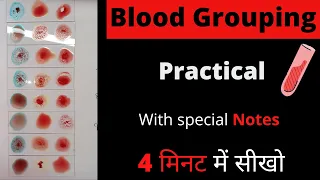 Blood group practical || Forward Blood Grouping || Test || Procedure || Hindi || Hematology