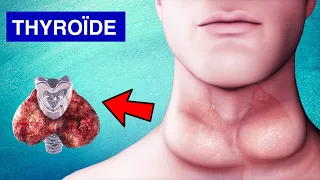 Glande Thyroïde : Pathologies, Symptômes et Traitements