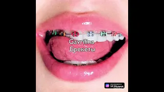 gavrilina брекеты  - speed up