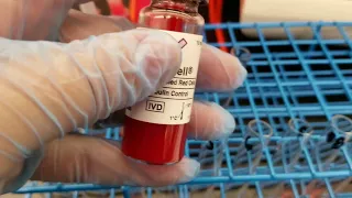 Blood Banking: Antibody Identification Panel Part 2