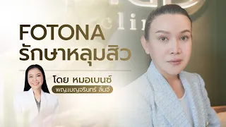 รักษาหลุมสิว อย่างตรงจุดกับคุณหมอเบนซ์ MDI CLINIC