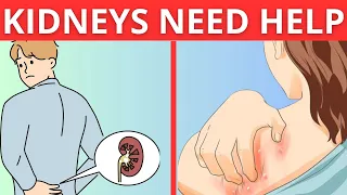 10 Alarming SIGNS Your Kidneys FAILING ! (You Must Not Ignore)