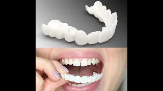 Съемные виниры для зубов Snap On Smile. Универсальные виниры на зубы