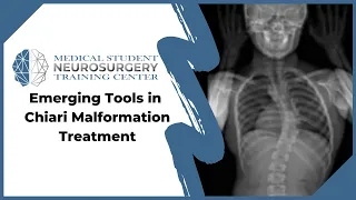 Emerging Tools in Chiari Malformation Treatment