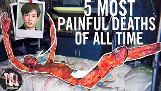 *GRAPHIC* 5 Most Painful Deaths In History | Mans Skin Melts Off | Most Radioactive Man In The World