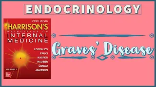 GRAVES' DISEASE | Hyperthyroidism | Etiopathogenesis | Clinical Features | Diagnosis | Treatment