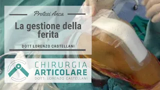 Come gestire la ferita dopo intervento di protesi d'anca e di ginocchio