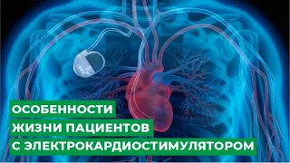 Особенности жизни пациентов с электрокардиостимулятором