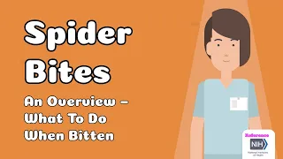 Spider Bites  - An Overview – What To Do When Bitten