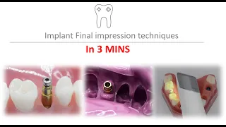 Implant impression techniques in 3 mins - closed tray - open tray -scan