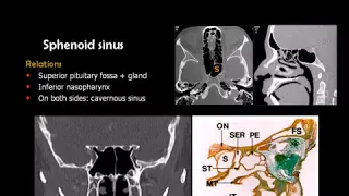 Dr Mamdouh Mahfouz head and neck imaging Sinonasal imaging  Clinicians