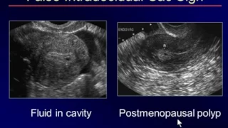 Sonography of the 1st Trimester Another Look