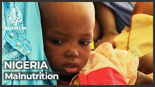 Doctors in Nigeria struggle to cope as acute malnutrition soars