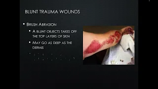 Blunt Force Trauma - Abrasions