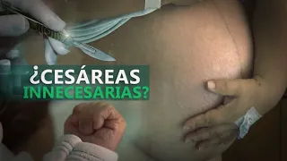 Madres denuncian que por cesáreas innecesarias ellas o sus hijos sufrieron daños irreversibles