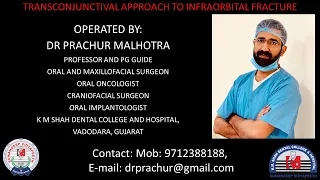 Transconjuctival approach for infraorbital fracture management.