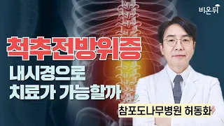 척추전방전위증도 내시경으로 치료가 가능할까 / 청담해리슨병원 신경외과 허동화