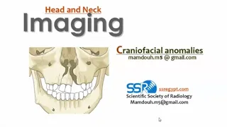 Imaging of craniofacial anomalies (DRE) Prof. Mamdouh Mahfouz