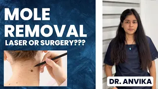 How To Remove An Unwanted Mole In Hindi ||  How To Get Rid Of Mole In Face? || Dr Anvika Mittal