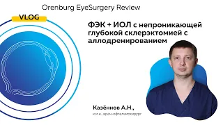 ФЭК + ИОЛ с непроникающей глубокой склерэктомией с аллодренированием