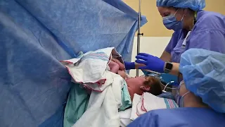 Skin-To-Skin Care Practice during a Cesarean Section Birth