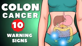 Colon Cancer Symptoms | Colorectal Cancer | 10 warning signs of Colon Cancer | Colon Cancer