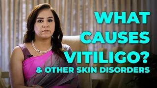 What causes Vitiligo?Dr. Nitika Kohli I Pt Education series