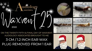 3 CM /1.2 INCH EAR WAX PLUG REMOVED FROM 1 EAR - EP710