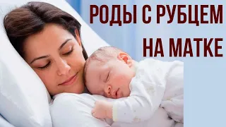 Роды с рубцом на матке. Кесарево сечение