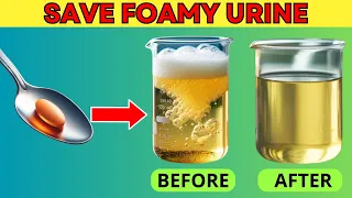 TOP 5 VITAMINS to Stop Proteinuria Fast and Heal Kidney | PureNutrition