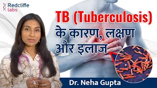 🔰 TB के कारण, लक्षण और इलाज  | 🔰TB (Tuberculosis) Causes, Symptoms And Treatment In Hindi