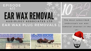 EAR WAX PLUG REMOVALS - EP411