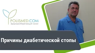 Синдром диабетической стопы: причины, последствия, прогноз, диагностика