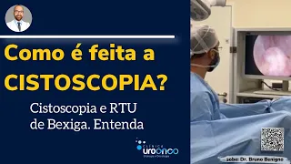 CISTOSCOPIA com Biópsia e RTU de Bexiga. Entenda o passo a passo em uma sala de cirurgia real