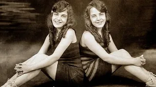 The Untold Truth Of The Conjoined Hilton Sisters