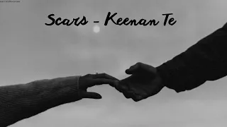 Scars - Keenan Te [ Vietsub + Lyrics ]