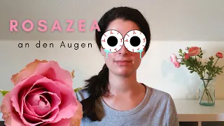 Rosazea an den Augen (Okuläre Rosazea)