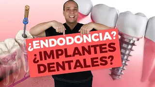 ¿Implante DENTAL o Endodoncia? 🤔 ¿Salvar mi DIENTE o Extraerlo, Cuál es la MEJOR opción? 🚀🚀