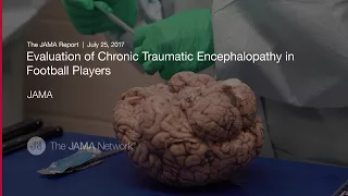 Evaluation of Chronic Traumatic Encephalopathy in Football Players