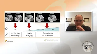 Small Renal Masses: An Overview