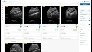 Automated Ultrasound Image Assessment from SonoSim