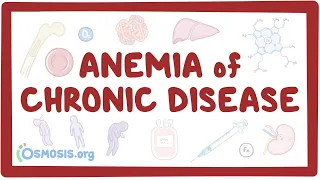 Anemia of chronic disease - an Osmosis Preview