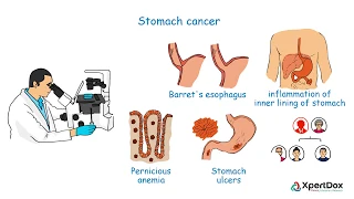 What is Stomach Cancer?