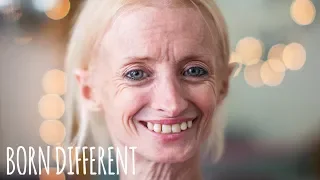 The Woman Who Ages Too Fast | BORN DIFFERENT