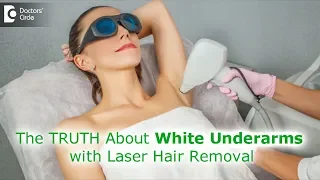 Myth or Fact: Can laser hair removal procedure whiten underarms?-Dr. Rashmi Ravindra|Doctors' Circle