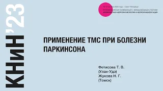 Применение ТМС при болезни Паркинсона. Фетисова Т. В.