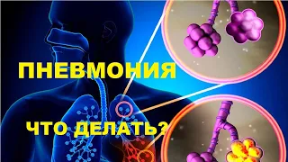 Пневмония. Что делать?