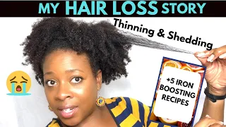 My Hair Loss Story | Iron deficiency Anemia & 5 Iron BOOSTING recipes| Low Iron